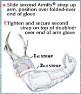 Fitting the Arm Glove to your Arm